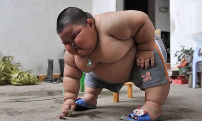 Obesidade infantil